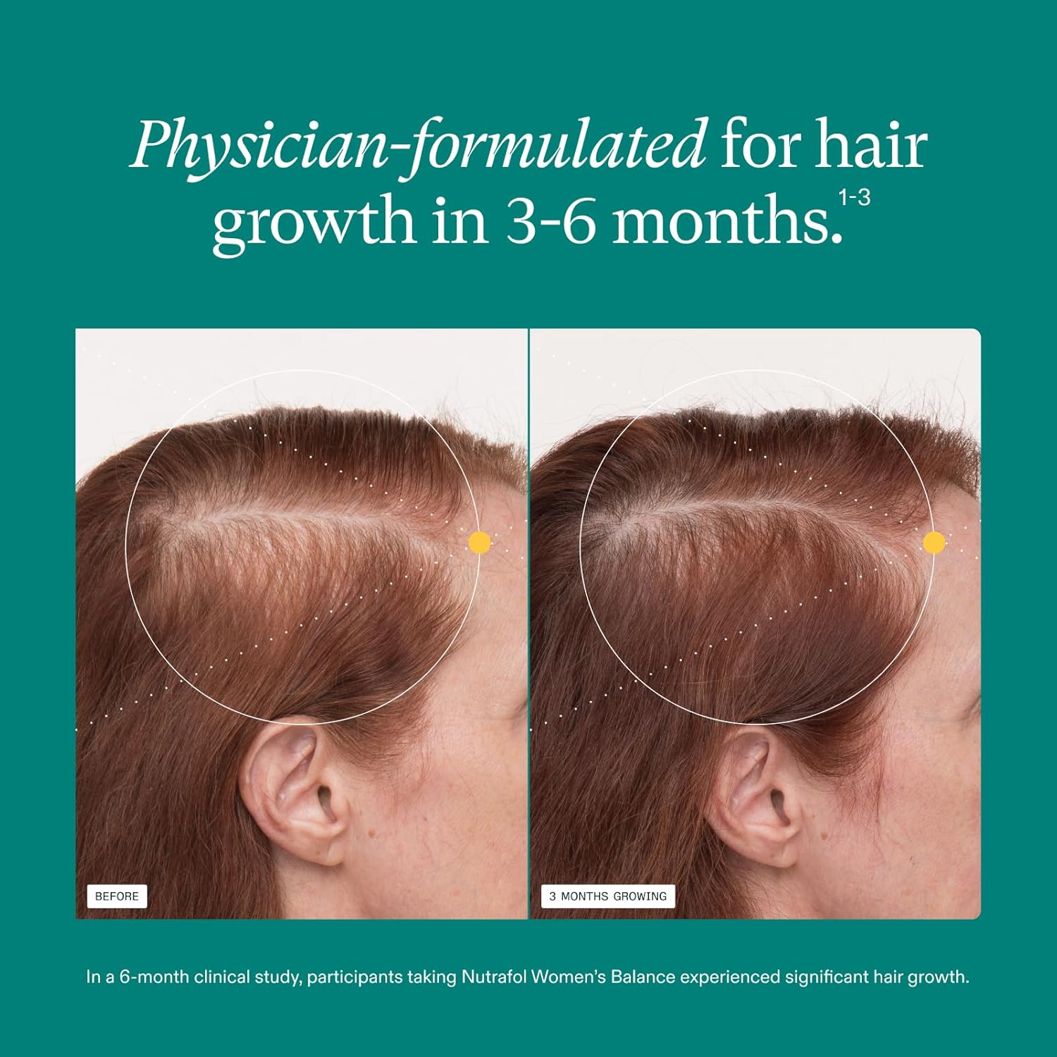 Thicker Hair Boost for Women